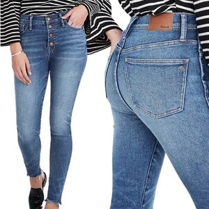 Madewell 10” High Button Fly Rise Skinny Jeans
